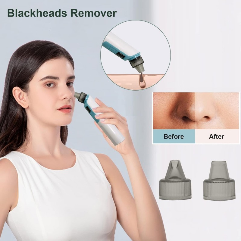 Aspirateur Nasal Bébé Electrique Rechargeable avec 6 Niveaux de Succion 4 Embouts d'aspiration Dissolvant de Points Noirs